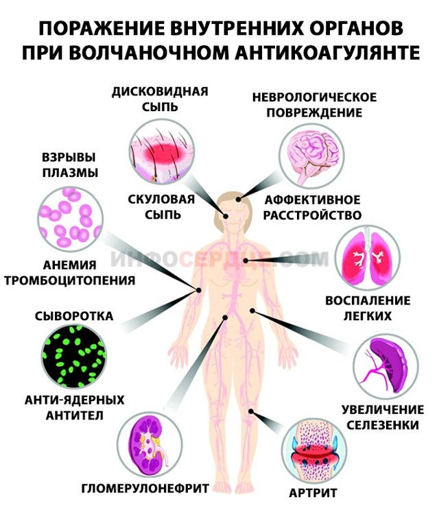 Волчаночный антикоагулянт в анализе беременной, подготовка к анализу