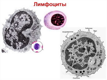 У взрослого повышены лимфоциты - о чем это говорит