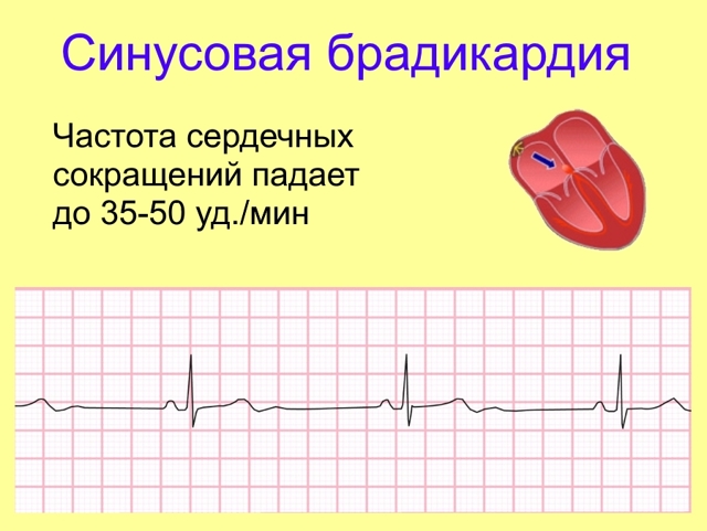 Бета-блокаторы: список препаратов. Сайт о лечении гипертонии. Учим, как снизить давление до нормы