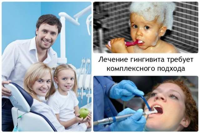 Гипертрофический гингивит