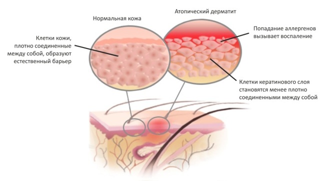 Красные пятна на теле у взрослого - появились красные пятнышки на лице