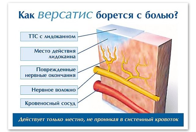 Лечебные пластыри для спины и суставов - обзор и применение