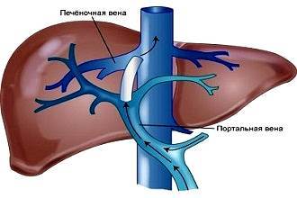 Билиарная гипертензия печени: симптомы, признаки на УЗИ и лечение синдрома