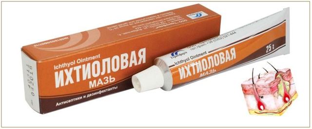 Ихтиоловая мазь – инструкция по применению, от чего помогает, аналоги препарата, отзывы, цена. Что лучше: Ихтиоловая мазь или мазь Вишневского. Ихтиоловые свечи от геморроя и других заболеваний
