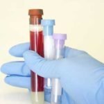 Функции и значение эозинофилов