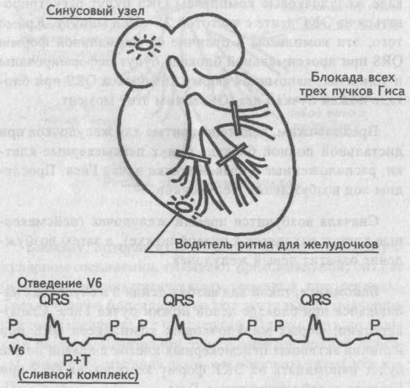 Атриовентрикулярная проводимость Википедия