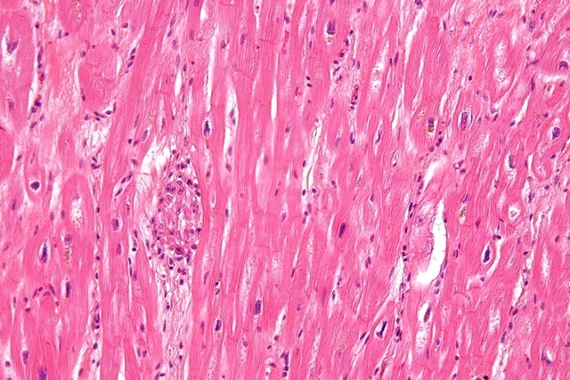 Сердце человека: анатомическое строение, функции, принцип работы