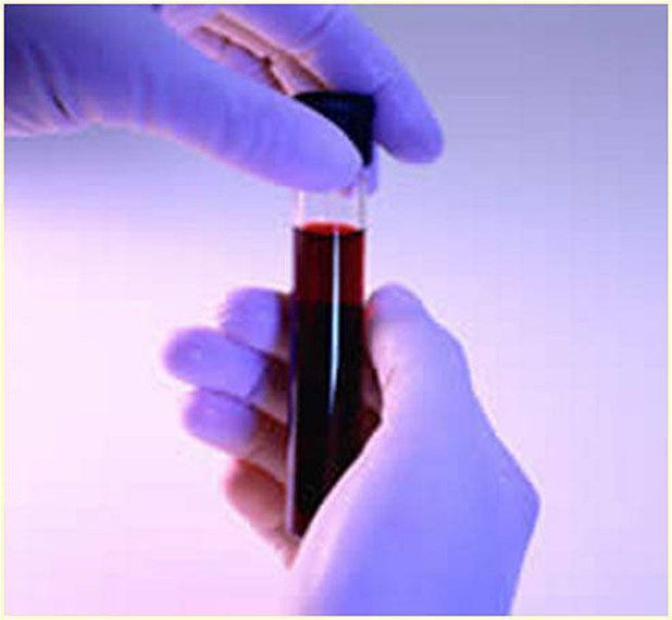 Сдать анализы на аллергены в Москве