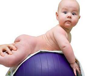 Мышечная гипотония у новорожденных и детей