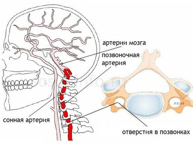 Асимметрия v4 сегментов позвоночных артерий d s. Можно ли вылечить синдром позвоночной артерии при остеохондрозе