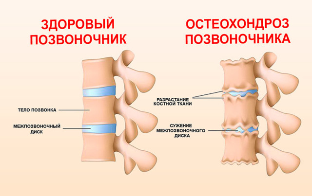 Низкое диастолическое давление – причины и меры лечения