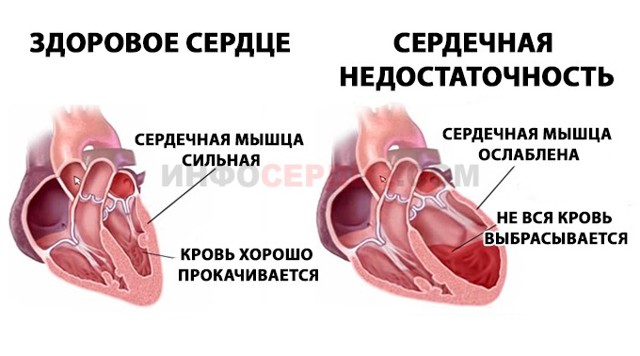 Первая помощь при острой сосудистой недостаточности
