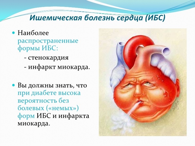Ишемическая болезнь сердца - причины, симптомы, лечение