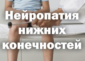 Мазь при полинейропатии нижних конечностей: классификация, медикаменты, народные средства, проявления