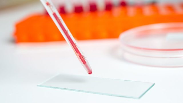 Избыток инсулина в крови: симптомы, что делать