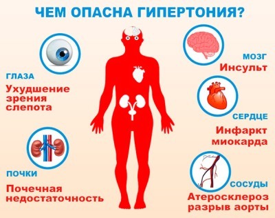 Типы и осложнения гипертонического криза