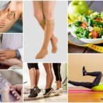 Послеоперационный период при операции на венах ног