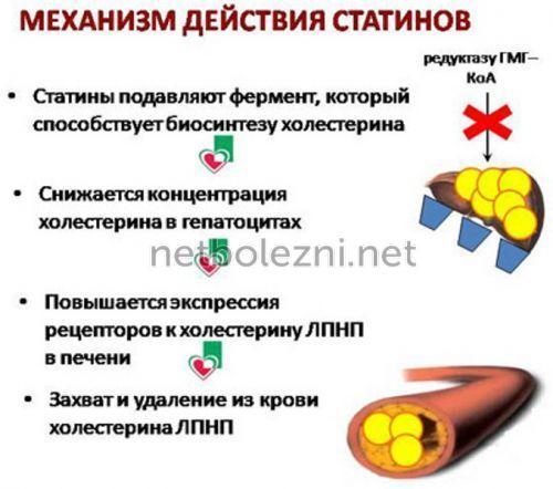Как снизить высокий холестерин причины и лечение