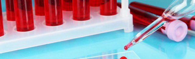 Диета по группе крови 1 положительная: таблица продуктов