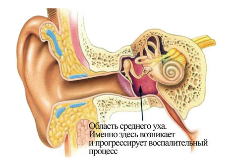 Абсцесс головного мозга - симптомы, лечение, причины, прогноз