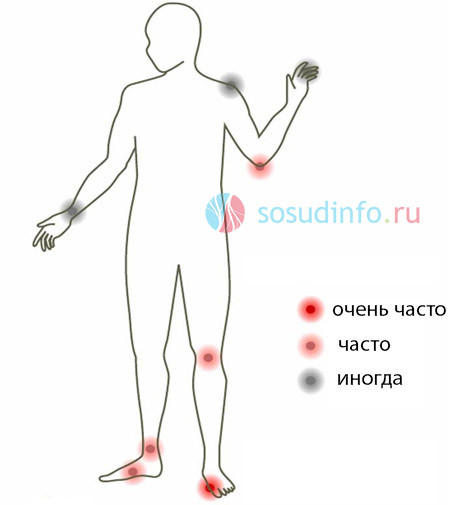 Мочевая кислота составляет уменя 755 что делать. Какая норма мочевой кислоты в крови мужчин, женщин и детей