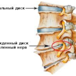 О Чем Говорит Боль в Грудной Клетке Посередине