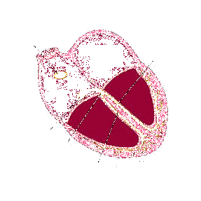 Нормосистолия, тахисистолия и брадисистолия на ЭКГ: что это, норма и патология