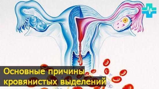 Выделения красные, но не месячные: причины