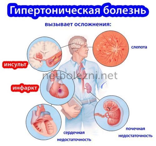 Ингибиторы АПФ: список препаратов при гипертонии. Ингибиторы АПФ – что это такое?
