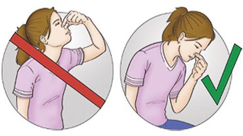 Первая помощь при кровотечениях