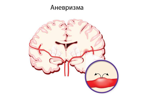 УЗДГ БЦА: что это такое, показания, расшифровка