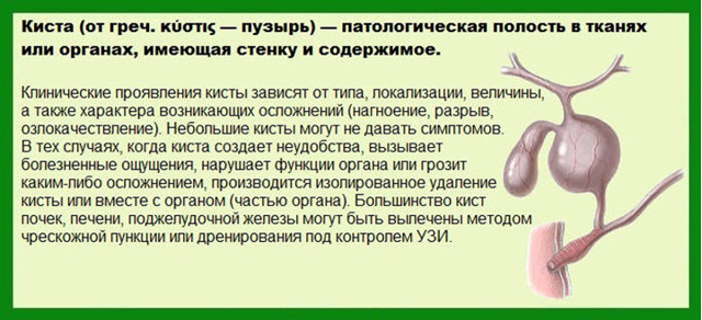 Киста сосудистого сплетения головного мозга: возникновение, диагностика, лечение. Опасна ли киста сосудистого сплетения для новорожденного?