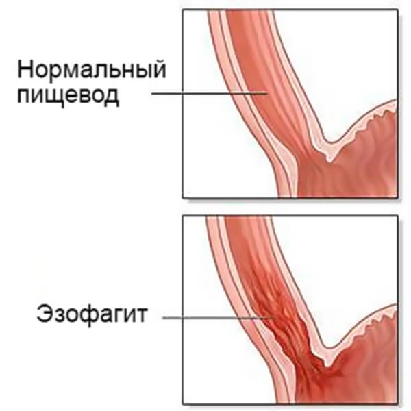 Боль в правой груди: что это может означать