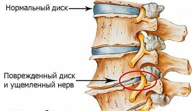 Боль в грудине посередине – в чем причины, что делать