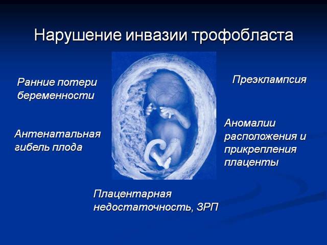 Нормы допплерографического исследования