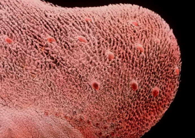 Коричневый налет на языке