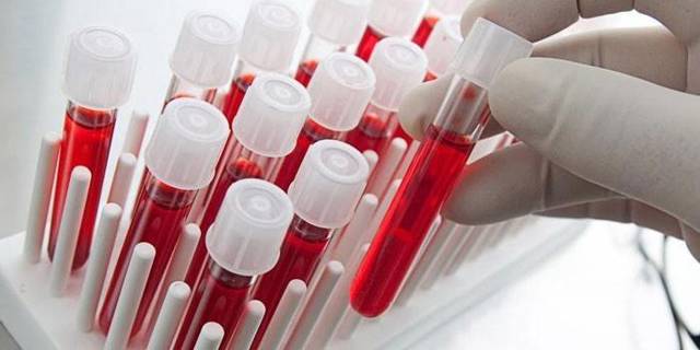 Анализ крови на МНО: показания, норма, расшифровка
