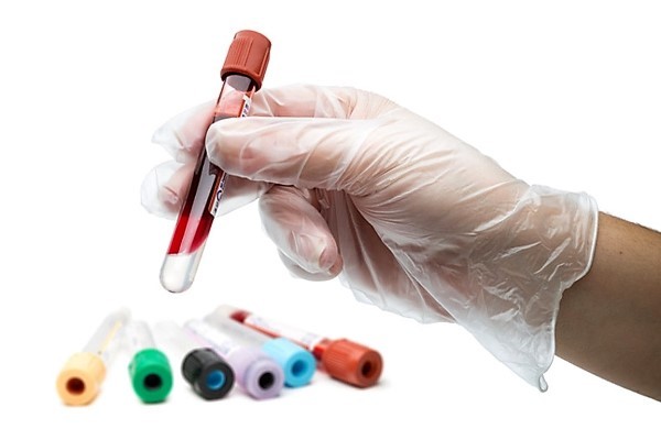 Повышены моноциты у взрослого: причины