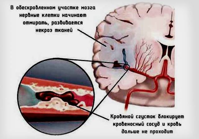 Симптомы Болезней Сосудов Шеи и Головы: Основные Проявления
