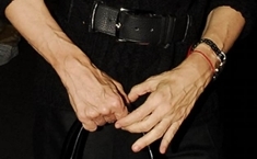 Почему видны вены на руках и как их убрать?