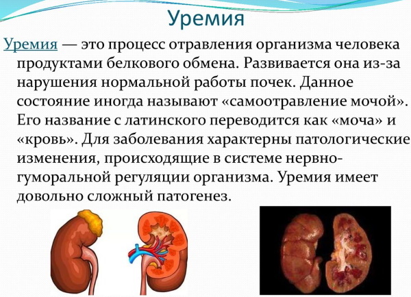Ретикулоциты норма у детей