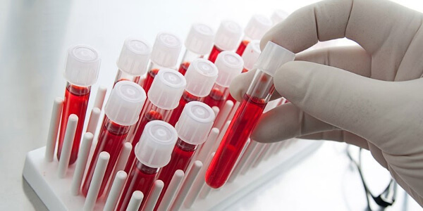 Анти-HCV положительный: что это значит, расшифровка