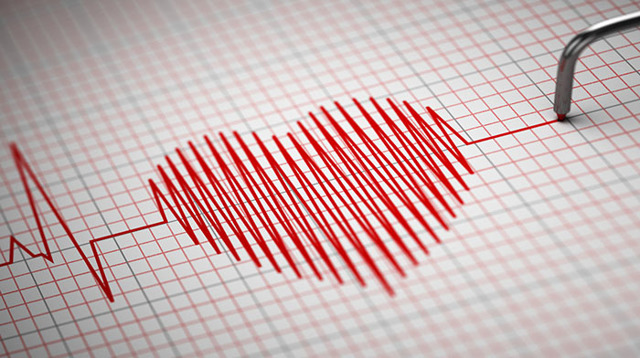 Как делают ЭКГ: техника наложения и снятия электродов, как снимают и накладывают