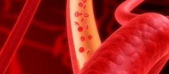 Киста яичника у женщин – причины, признаки и симптомы кисты левого и правого яичника у женщин. Последствия и разрыв кисты