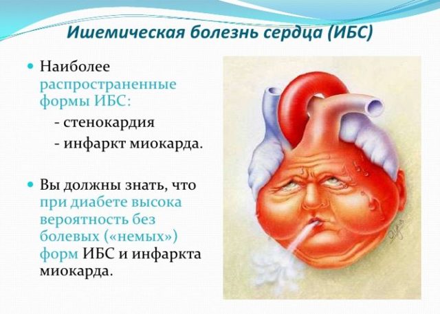 Ишемическая болезнь сердца - причины, симптомы, лечение