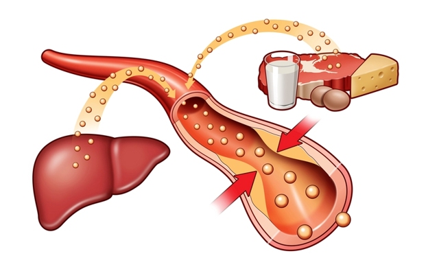 Холестерин плохой и хороший - опасность и норма у женщин