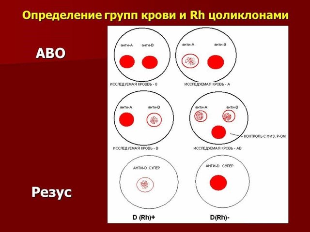 Определение группы крови по цоликлонам: как проводят, расшифровка результатов
