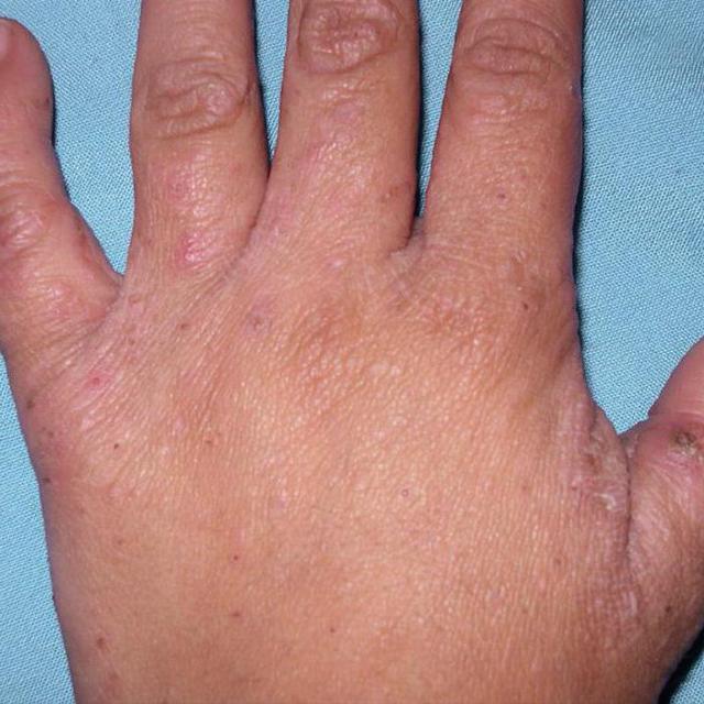 Спрегаль спрей: цена, инструкция по применению и отзывы