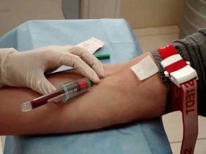 Какой анализ крови сдать чтобы проверить сахарный диабет — Лечим диабет
