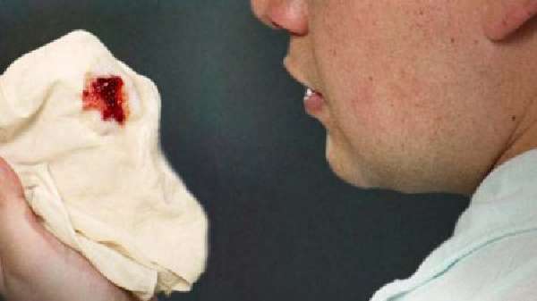 Жужжащее дыхание кровохарканье. Кровохарканье — Причины, Неотложная помощь